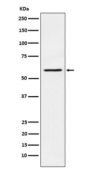 PAK1 Rabbit Monoclonal Antibody