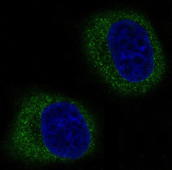 Mitofusin 2 MFN2 Rabbit Monoclonal Antibody