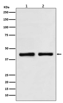 SNF5/SMARCB1 Rabbit Monoclonal Antibody