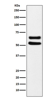 Ikaros Rabbit Monoclonal Antibody