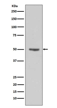 Cyclin E1/CCNE1 Rabbit Monoclonal Antibody
