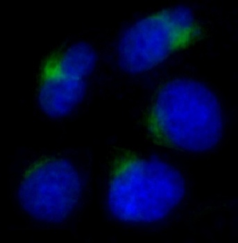 ADAM17/Tace Rabbit Monoclonal Antibody