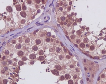 PRMT5 Rabbit Monoclonal Antibody
