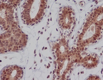 DNA-PKcs PRKDC/DNA Rabbit Monoclonal Antibody
