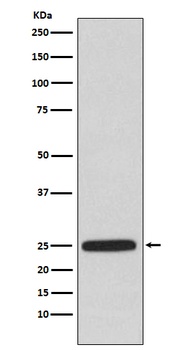 HPRT HPRT1 Rabbit Monoclonal Antibody