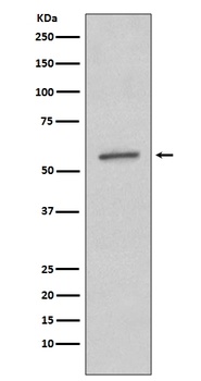 SGK1/Sgk Rabbit Monoclonal Antibody