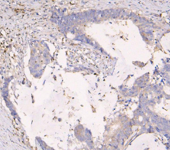 APOBEC3G Mouse Monoclonal Antibody