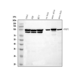 FOXP1 Rabbit Monoclonal Antibody