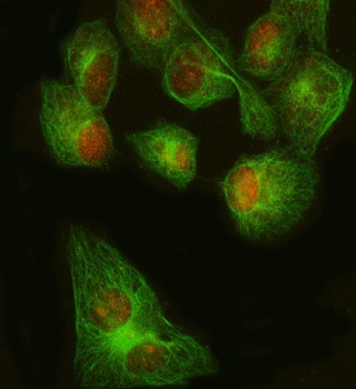 FOXP1 Rabbit Monoclonal Antibody