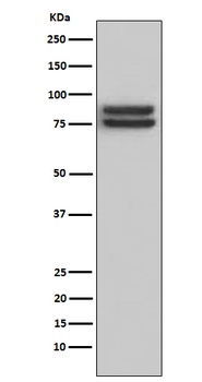 FOXP1 Rabbit Monoclonal Antibody