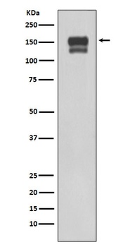 Integrin beta 1 ITGB1 Rabbit Monoclonal Antibody