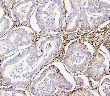 Collagen III/COL3A1 Mouse Monoclonal Antibody