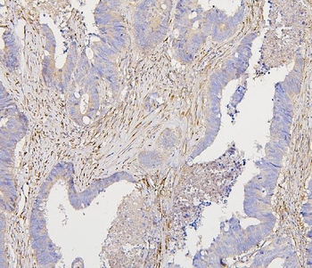 Collagen III/COL3A1 Mouse Monoclonal Antibody