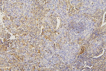 Collagen III/COL3A1 Mouse Monoclonal Antibody