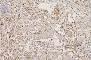 Collagen III/COL3A1 Mouse Monoclonal Antibody