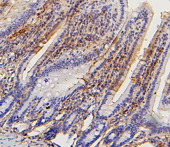 Collagen III/COL3A1 Mouse Monoclonal Antibody