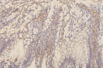 Collagen III/COL3A1 Mouse Monoclonal Antibody