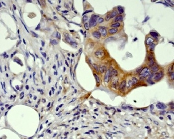 GSK3 beta Rabbit Monoclonal Antibody