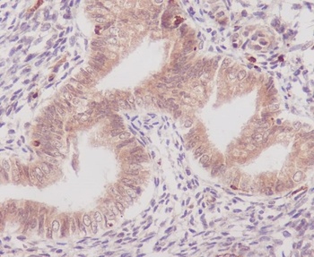 COX1 PTGS1 Rabbit Monoclonal Antibody