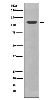 CD34 Rabbit Monoclonal Antibody
