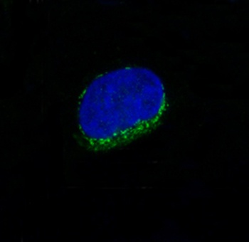 CD34 Rabbit Monoclonal Antibody