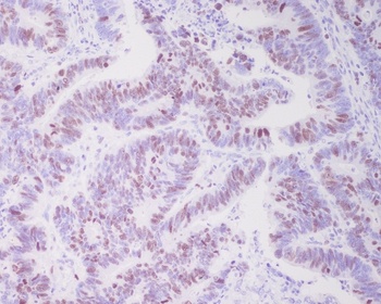 Topoisomerase II alpha TOP2A Rabbit Monoclonal Antibody