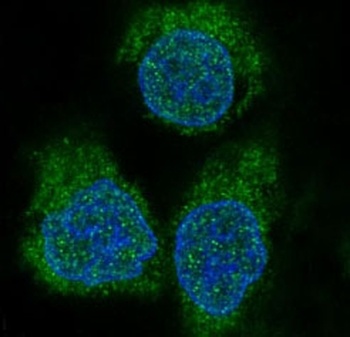 eIF4EBP1/4Ebp1 Rabbit Monoclonal Antibody
