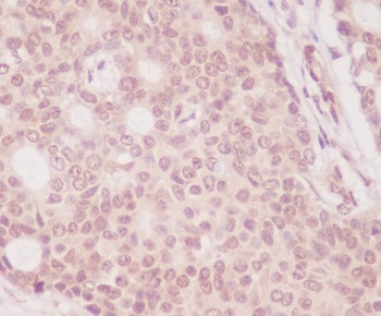 eIF4EBP1/4Ebp1 Rabbit Monoclonal Antibody