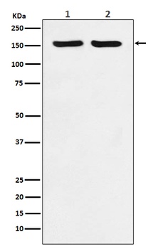 ROCK2 Rabbit Monoclonal Antibody