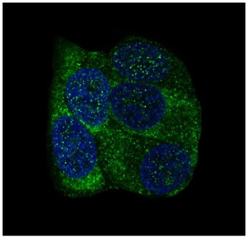 YB1 YBX1 Rabbit Monoclonal Antibody
