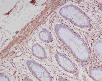 alpha smooth muscle Actin ACTA2 Rabbit Monoclonal Antibody