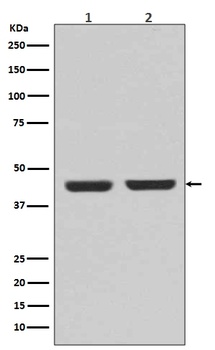 alpha smooth muscle Actin ACTA2 Rabbit Monoclonal Antibody
