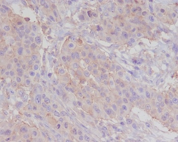 alpha smooth muscle Actin ACTA2 Rabbit Monoclonal Antibody