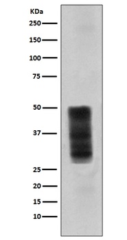 CD63 Rabbit Monoclonal Antibody