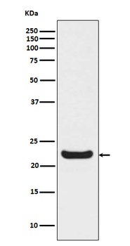 RBP4 Rabbit Monoclonal Antibody