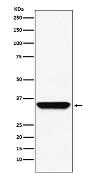 ADORA1 Rabbit Monoclonal Antibody