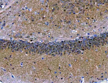 MEF2A+MEF2C/MEF2A Rabbit Monoclonal Antibody