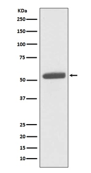 PKM2 Rabbit Monoclonal Antibody