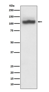 SERCA2 ATP2A2 Rabbit Monoclonal Antibody