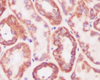 Prohibitin PHB Rabbit Monoclonal Antibody
