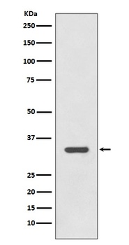 HLA-DRA/Hla Dr/DRA Rabbit Monoclonal Antibody
