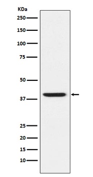 RING2/RING1B/RNF2 Rabbit Monoclonal Antibody