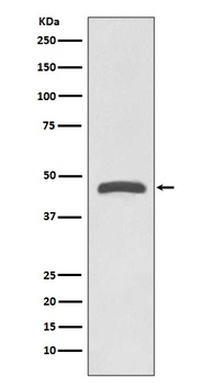 TSG101 Rabbit Monoclonal Antibody