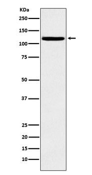 HAUSP/USP7 Rabbit Monoclonal Antibody