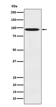 CDT2 Rabbit Monoclonal Antibody