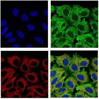 beta Actin ACTB Rabbit Monoclonal Antibody