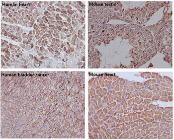 beta Actin ACTB Rabbit Monoclonal Antibody