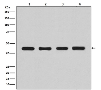 beta Actin ACTB Rabbit Monoclonal Antibody