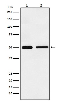 TIM1 HAVCR1 Rabbit Monoclonal Antibody