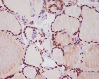 TTF1 NKX2-1/NKX2 Rabbit Monoclonal Antibody